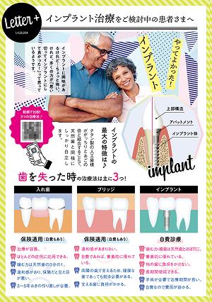 インプラサンプル